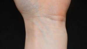 De ce sunt venele albastre. Explicaţia simplă, dar ştiinţifică