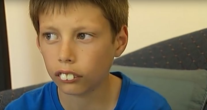 Copilul poreclit "Puştiul-iepure" nu mai are aspectul de odinioară. Cum arată acesta după ce a suferit mai multe operaţii