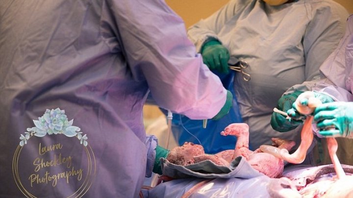 REACŢIA FABULOASĂ a unui bebeluş care a venit pe lume, după un travaliu chinuitor de patru zile. Medicii, UIMIŢI (FOTO)