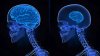 Cercetătorii au demonstrat: Creierul uman se poate micşora din cauza stresului