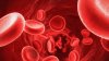 Ziua internațională a hemofiliei. Câţi moldoveni suferă de această boală