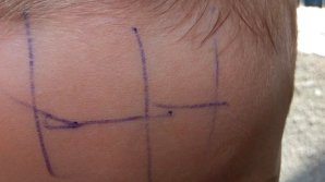 ȘOCANT. O educatoare a scris cu pixul pe fruntea unui copil de patru ani