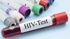 Anunţ îngrijorător: A fost descoperită o nouă formă de HIV