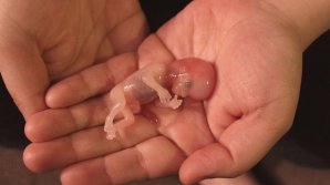 Sunt minore și vor să facă AVORT! Cum întrerup sarcina aceste copile (VIDEO)