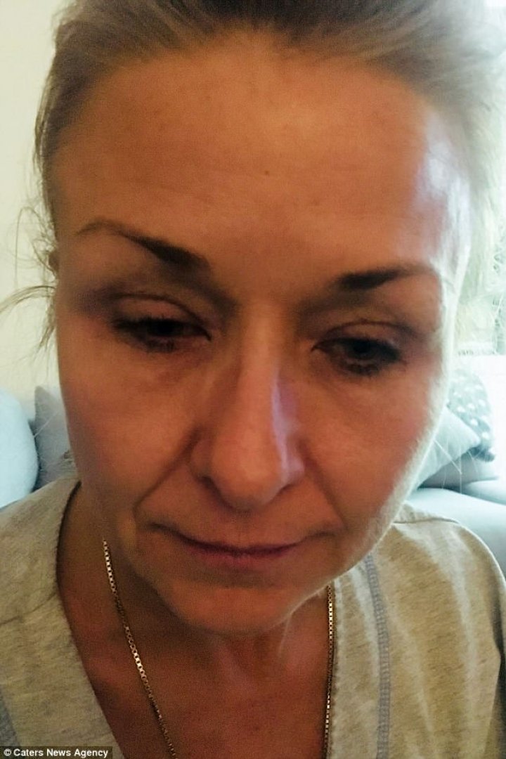 AVERTISMENT! Ce a pățit o femeie care obișnuia să folosească rimel. Imagini șocante