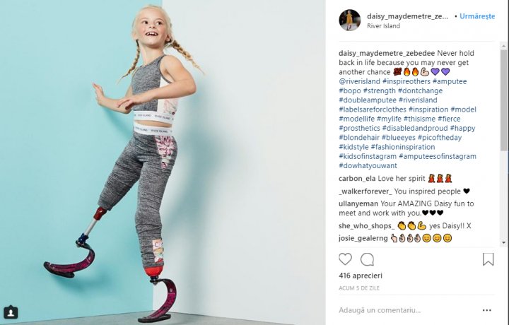 O fetiţă cu picioarele amputate inspiră mii de persoane cu lecţia de viaţă pe care o oferă (FOTO)