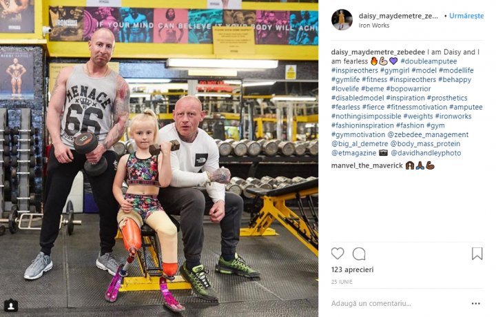 O fetiţă cu picioarele amputate inspiră mii de persoane cu lecţia de viaţă pe care o oferă (FOTO)