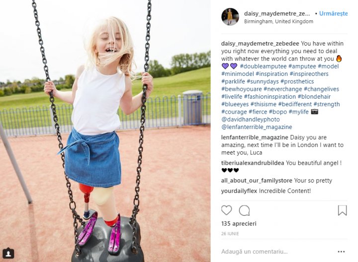 O fetiţă cu picioarele amputate inspiră mii de persoane cu lecţia de viaţă pe care o oferă (FOTO)