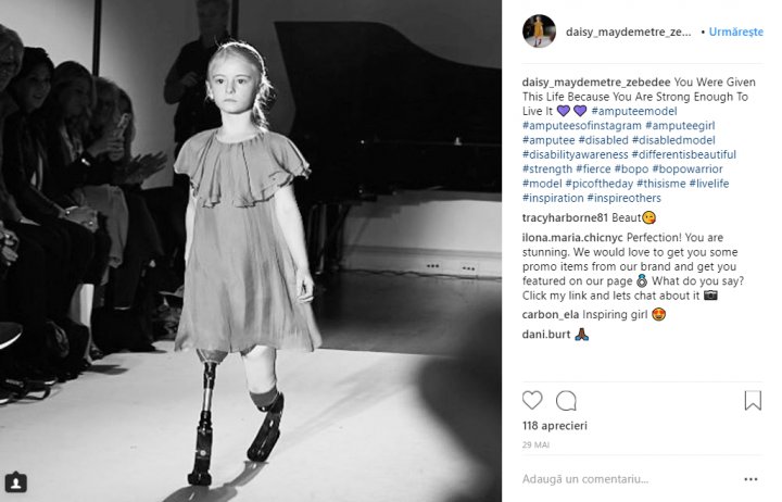 O fetiţă cu picioarele amputate inspiră mii de persoane cu lecţia de viaţă pe care o oferă (FOTO)