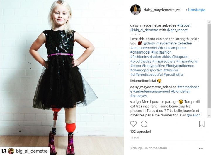 O fetiţă cu picioarele amputate inspiră mii de persoane cu lecţia de viaţă pe care o oferă (FOTO)