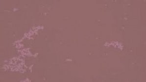 Fenomen bizar la Bălţi. Apa a devenit de culoare roșie. Care este motivul