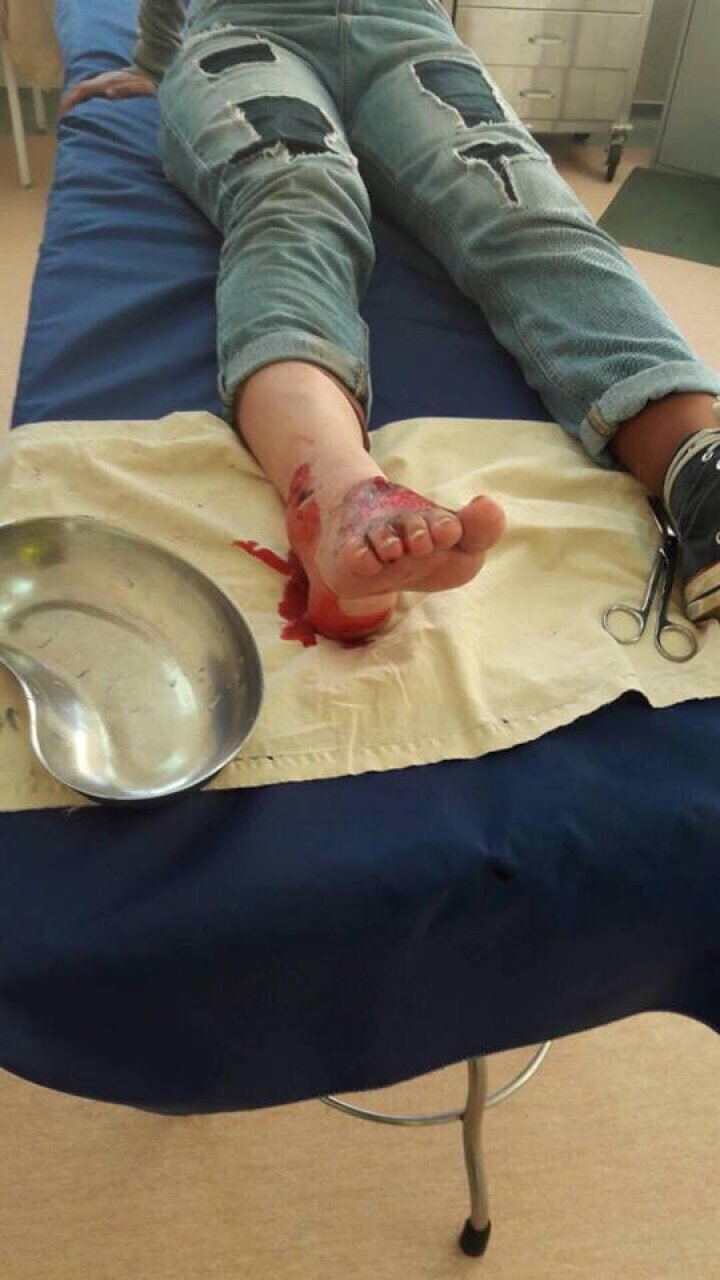 ACCIDENT DE GROAZĂ la intrarea în Durleşti: O tânără, lovită de un microbuz de linie pe o trecere de pietoni (FOTO)