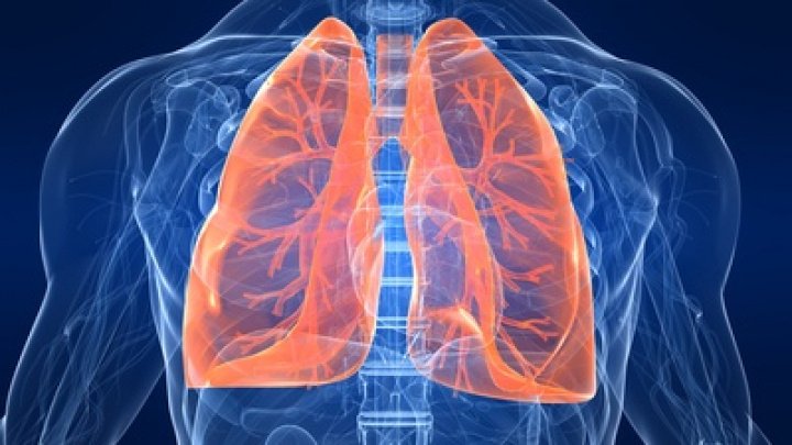 Focar de pneumonie în Italia: Autorităţile suspectează o sursă de apă contaminată