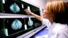 O parlamentară insistă asupra introducerii screening-ului cancerului mamar