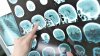 Oamenii de știință au conectat creierele a trei oameni pentru a-i ajuta să împărtășească gândurile.  Ce s-a întâmplat