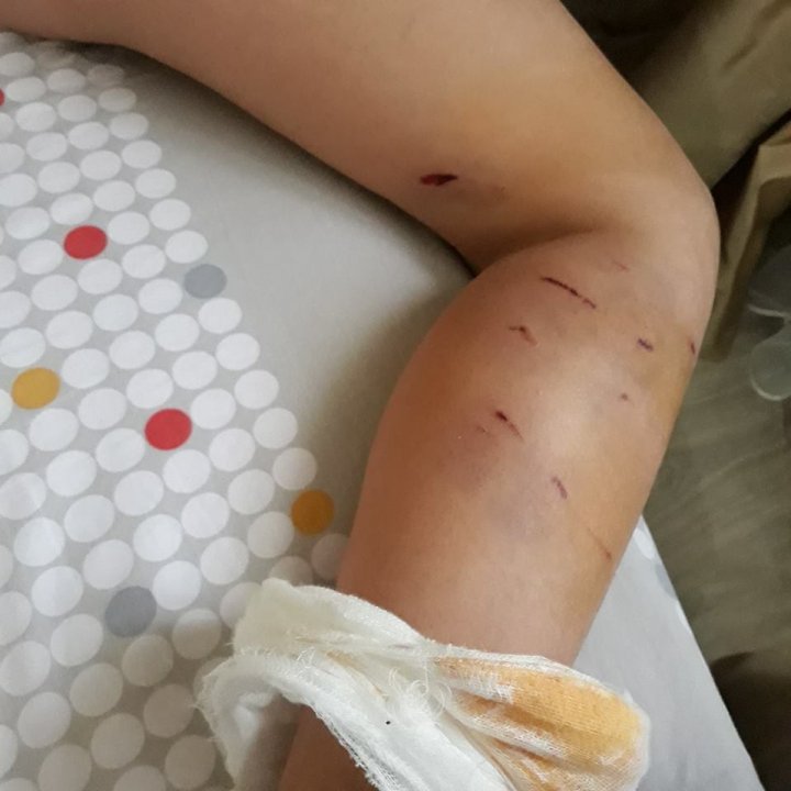 Atacul câinilor fără stăpân: Un copil din Drochia a ajuns la spital, după ce a fost atacat de o haită de maidanezi, chiar în curtea şcolii (GALERIE FOTO)