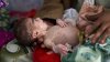 STATISTICI ÎNGROZITOARE: Aproximativ 85.000 de copii au murit de malnutriţie din cauza crizei din Yemen