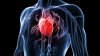 TREBUIE SĂ ŞTII! Simptomele celor mai comune boli de inimă
