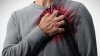 Factorii din jurul nostru care sporesc riscul de infarct și atac cerebral
