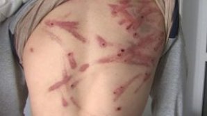 DETALII NOI în cazul COPIILOR MALTRATAŢI de la Nisporeni. MOTIVUL pentru care tatăl ŞI-A BĂTUT CU BESTIALITATE cei doi feciori (IMAGINI CU PUTERNIC IMPACT EMOŢIONAL)