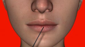 O femeie din China a murit după o supradoză cu botox, într-o clinică de înfrumusețare