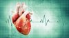 Avertismentul unui medic: Aritmia cardiacă poate provoca moartea subită