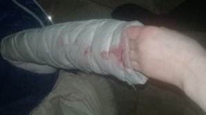 Un șofer de maxi-taxi i-a spart nasul unui minor pentru că nu i-a dat la timp trei lei (FOTO)