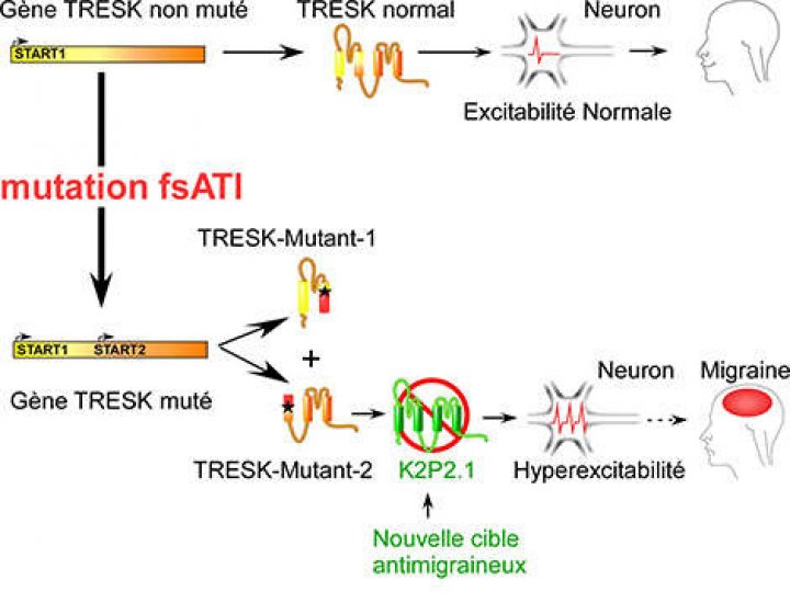 Un nou mecanism aflat la originea atacurilor migrenoase, identificat (FOTO)