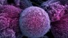 Studiu: Cel mai folosit erbicid din lume crește cu 40% riscul îmbolnăvirii de cancer