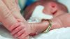 ÎNGERII COPIILOR: 11 mii de bebeluşi născuţi prematur, salvaţi la Spitalul Municipal numărul 1