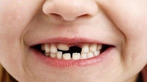 Bine de știut! Ce înseamnă când visezi că îţi cad dinţii