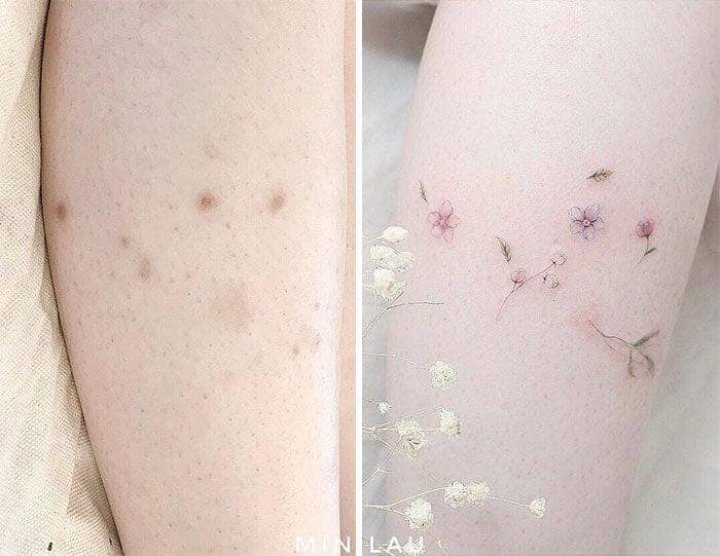 IMAGINI UIMITOARE care te lasă cu gura cască! Şi-au transformat semnele în opere de artă cu ajutorul tatuajului