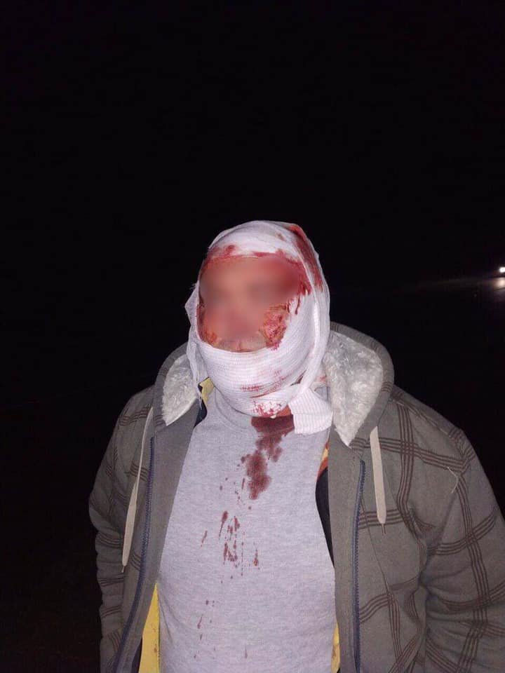 CEAŢA FACE RAVAGII în ţară. ACCIDENT GRAV în raionul Călăraşi: Sunt victime. Poliţia îndeamnă şoferii să fie precauţi (FOTO)