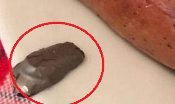 Momente de groază pentru un bărbat, care a mâncat CÂRNĂCIORI cu "umplutură" neobişnuită: "Putea să-mi perforeze intestinele"