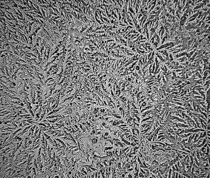 Cum arată lacrimile la microscop și ce spun despre noi