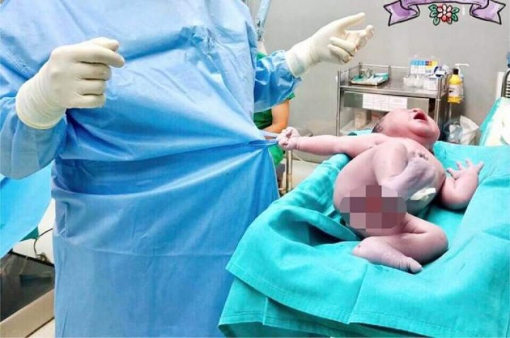 ADORABIL! Ce face un bebeluş, la câteva momente după naştere. Medicul a rămas fără cuvinte (FOTO)