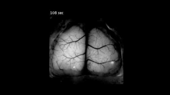 Oamenii de știință au creat un craniu 3D transparent care oferă posibilitatea studierii creierului în timp real