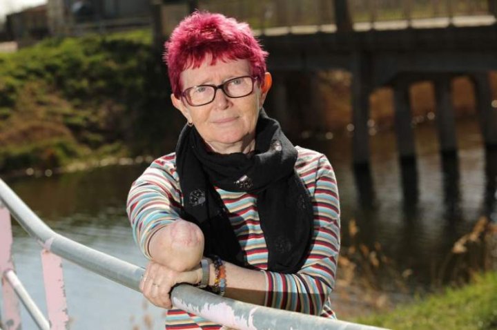 I-a smuls braţul DIN COT! O femeie a fost atacată cu bestialitate de PROPRIUL câine în grădina casei (FOTO)