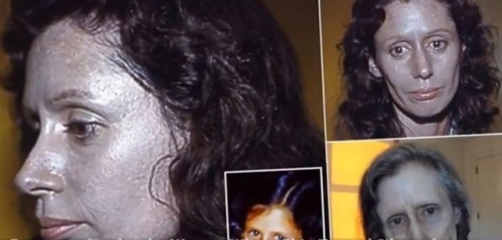 O femeie a ajuns să ARATE CA UN MONSTRU din cauza picăturilor nazale (FOTO)