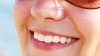 Trucuri surprinzatoare pentru dinti mai albi si un zambet de milioane