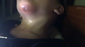 CLIPE DE GROAZĂ pentru un copil. A rămas cu barba spartă, după ce a căzut într-o gură de canalizare