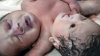 O tânără de 21 de ani a născut un bebeluș cu două capete și trei mâini (FOTO)