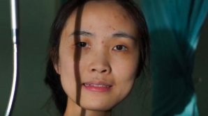 Cazul inedit al unei femei cu o boală rară: De 11 ani locuiește într-un spital