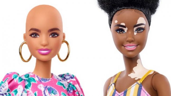 Păpuşi Barbie fără păr şi cu vitiligo, produse de grupul Mattel