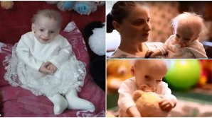 A trăit opt ani, dar avea 80! POVESTEA TRAGICĂ a unei fetiţe din Ucraina, care a fost răpusă de progeria