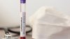 Ministerul Sănătății a anunțat lista laboratoarelor din țară unde vor fi efectuate teste pentru depistarea coronavirusului