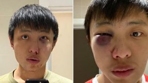 Atac rasist la Londra. Ce a păţit un tânăr din cauza coronavirusului (FOTO)