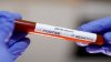 China raportează şase noi îmbolnăviri cu coronavirus