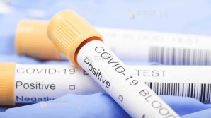 Un grup de medici face apel la donatori pentru a cumpăra un dispozitiv medical necesar pacienților cu COVID-19