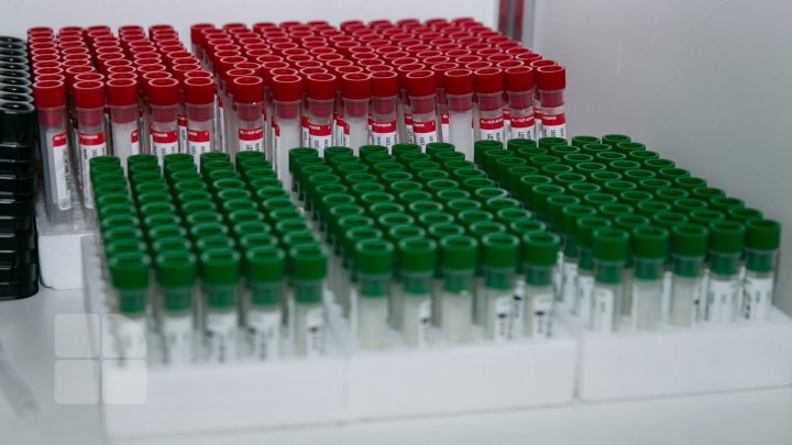 Germania începe testarea de detecţie anticorpi COVID-19 pentru a afla mai multe despre noul coronavirus